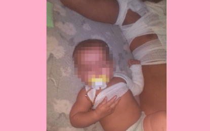 Baby, mom burnt after man throws hot oil on brother during argument