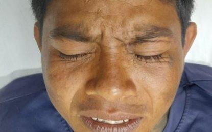 Wanted murder suspect shot during police capture