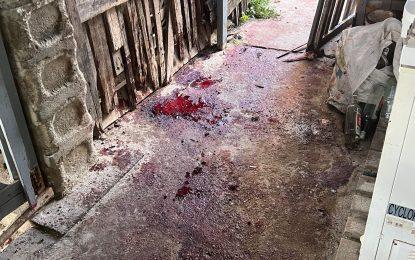 2 shot dead, 6 injured in Buxton shooting