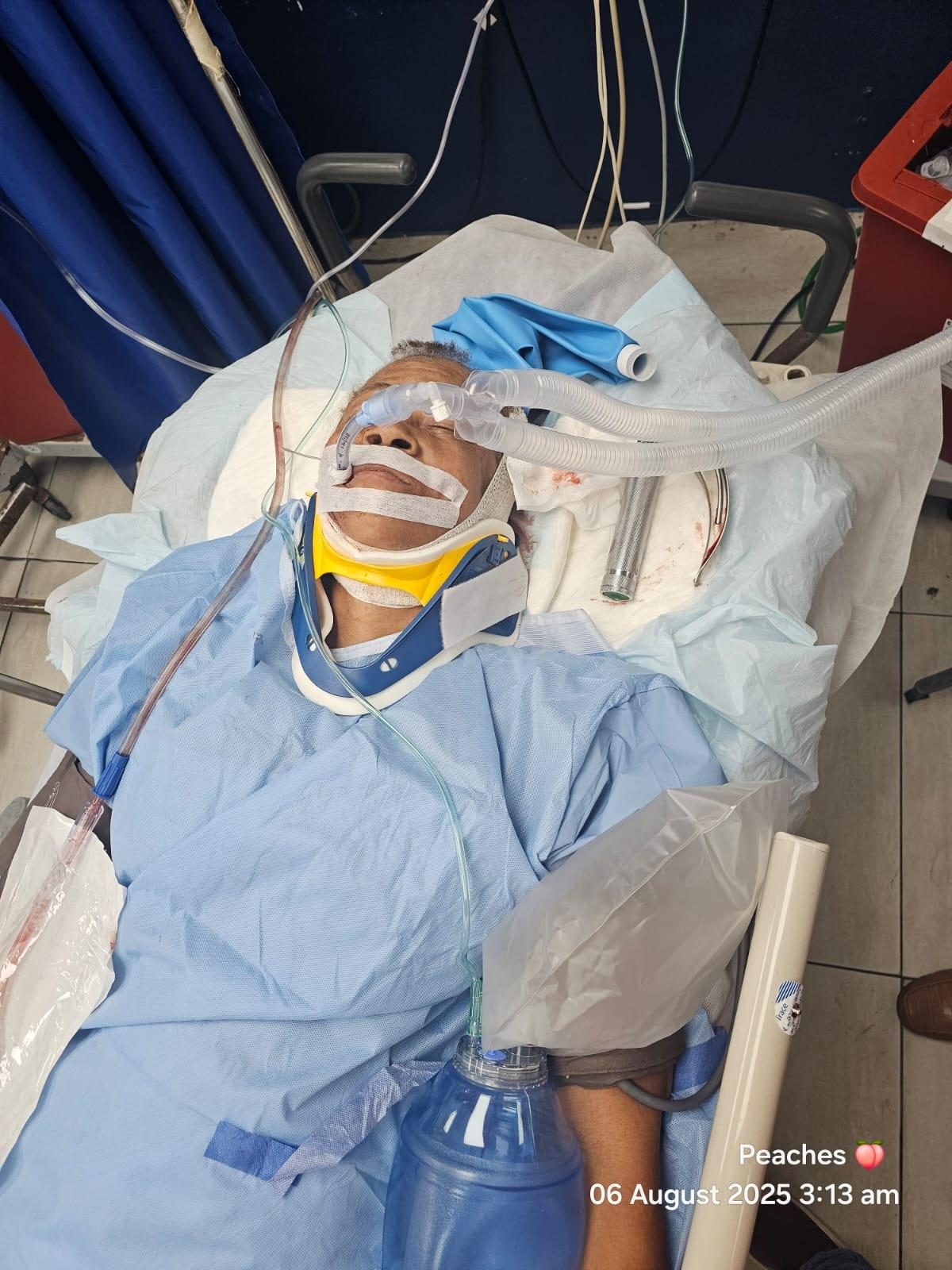 Woman critical after hit by diplomatic vehicle