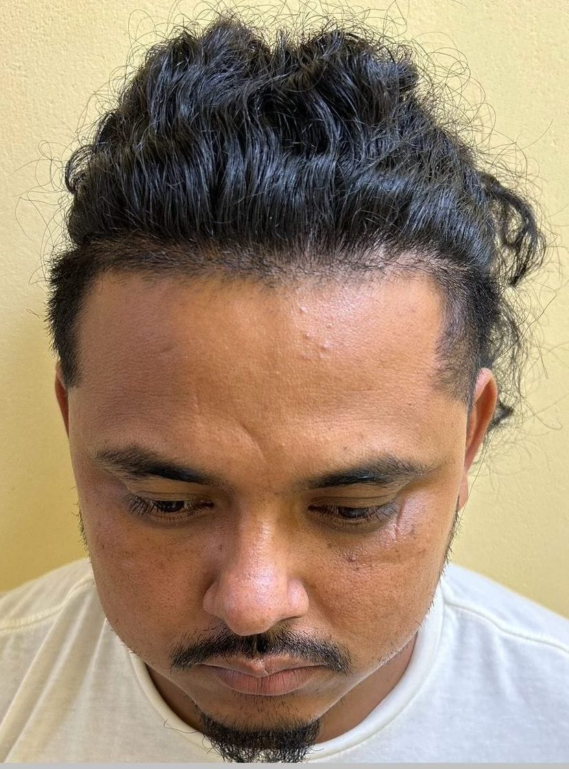 Woman stabbed 24 times fears for life