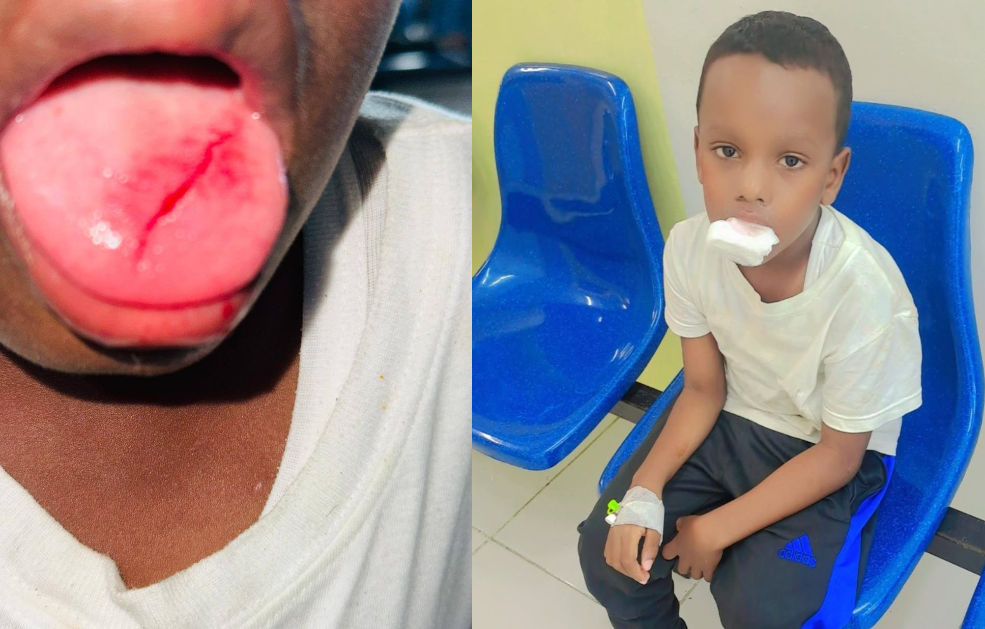 Schoolboy’s tongue slashed in bullying attack