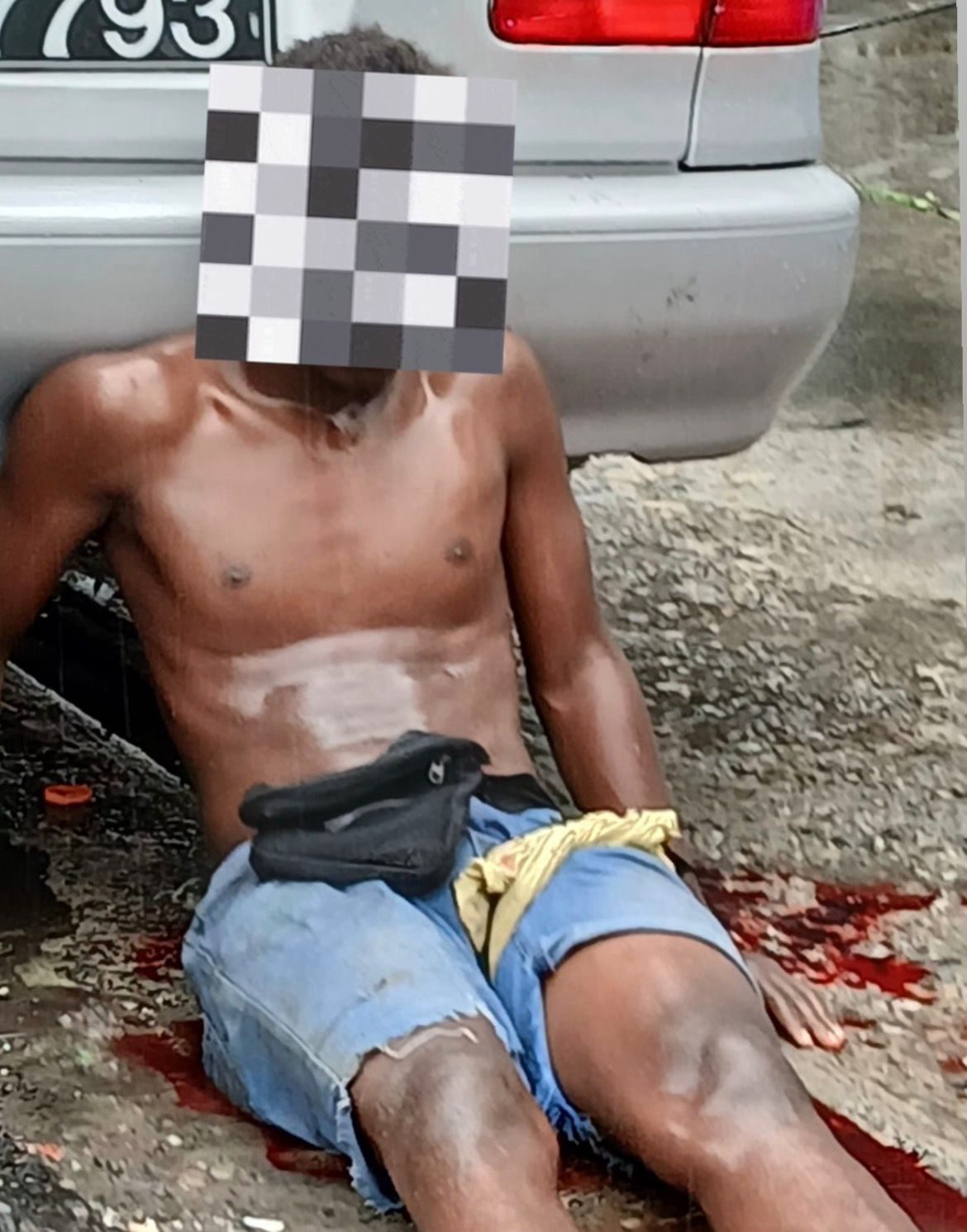 Teen shot during botched robbery outside Brickdam Cathedral