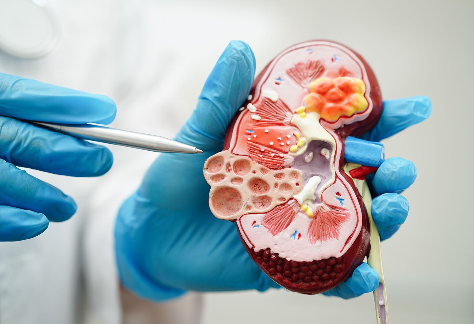 Man 51, in end stage kidney failure, seeks donation of organ