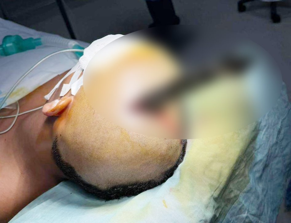 Knife removed from teen’s brain