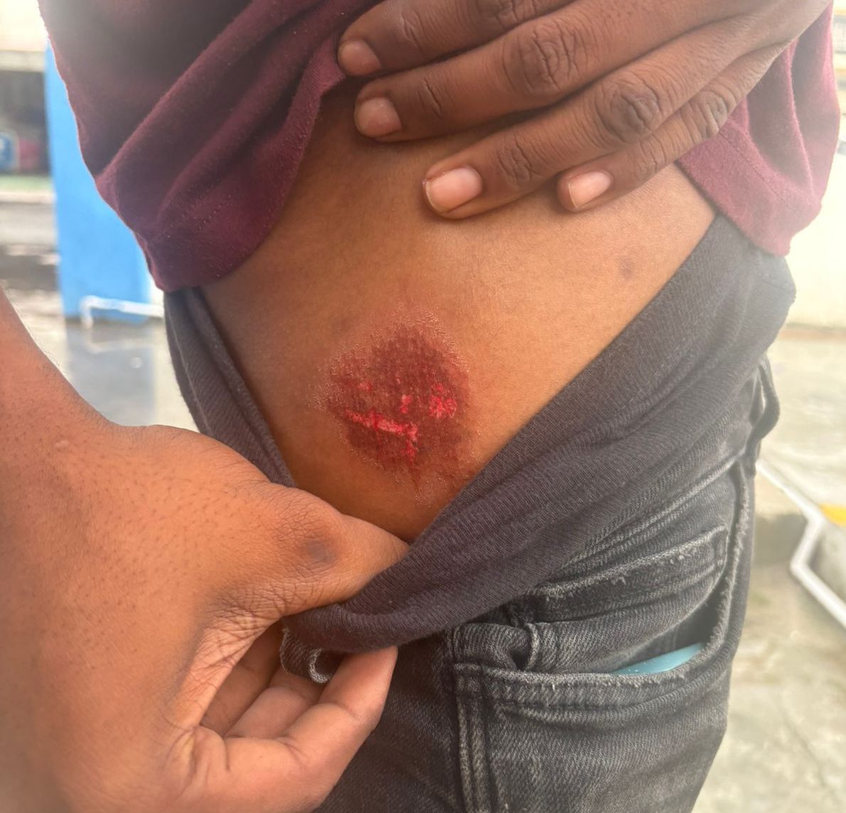 Bandits escape as police open fire on innocent teens