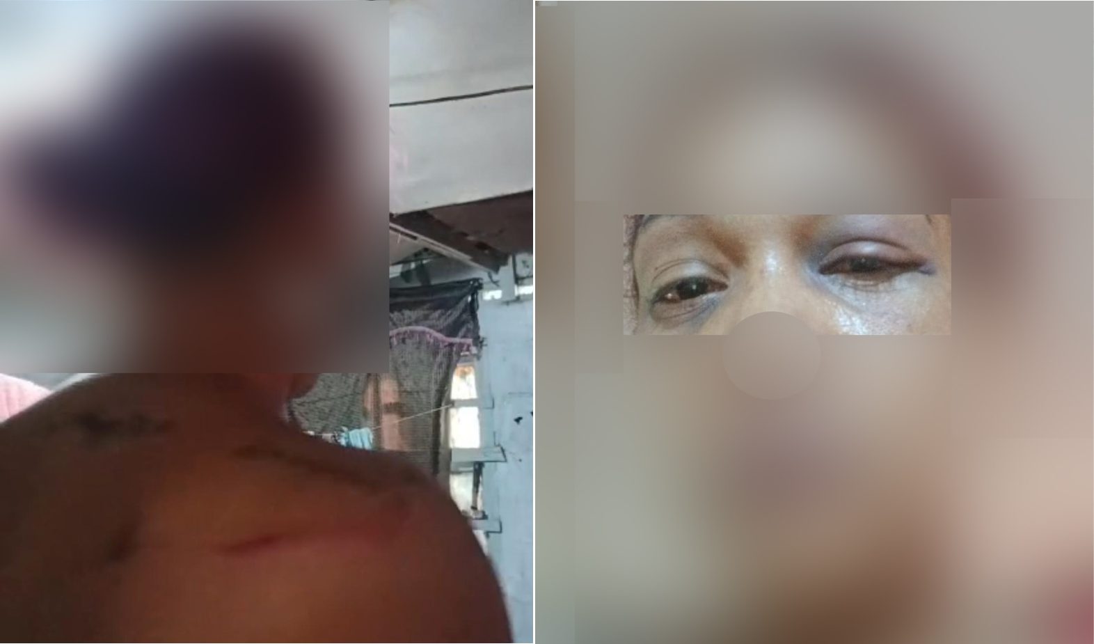 Venezuelan woman beaten, dumped naked by ex-lover