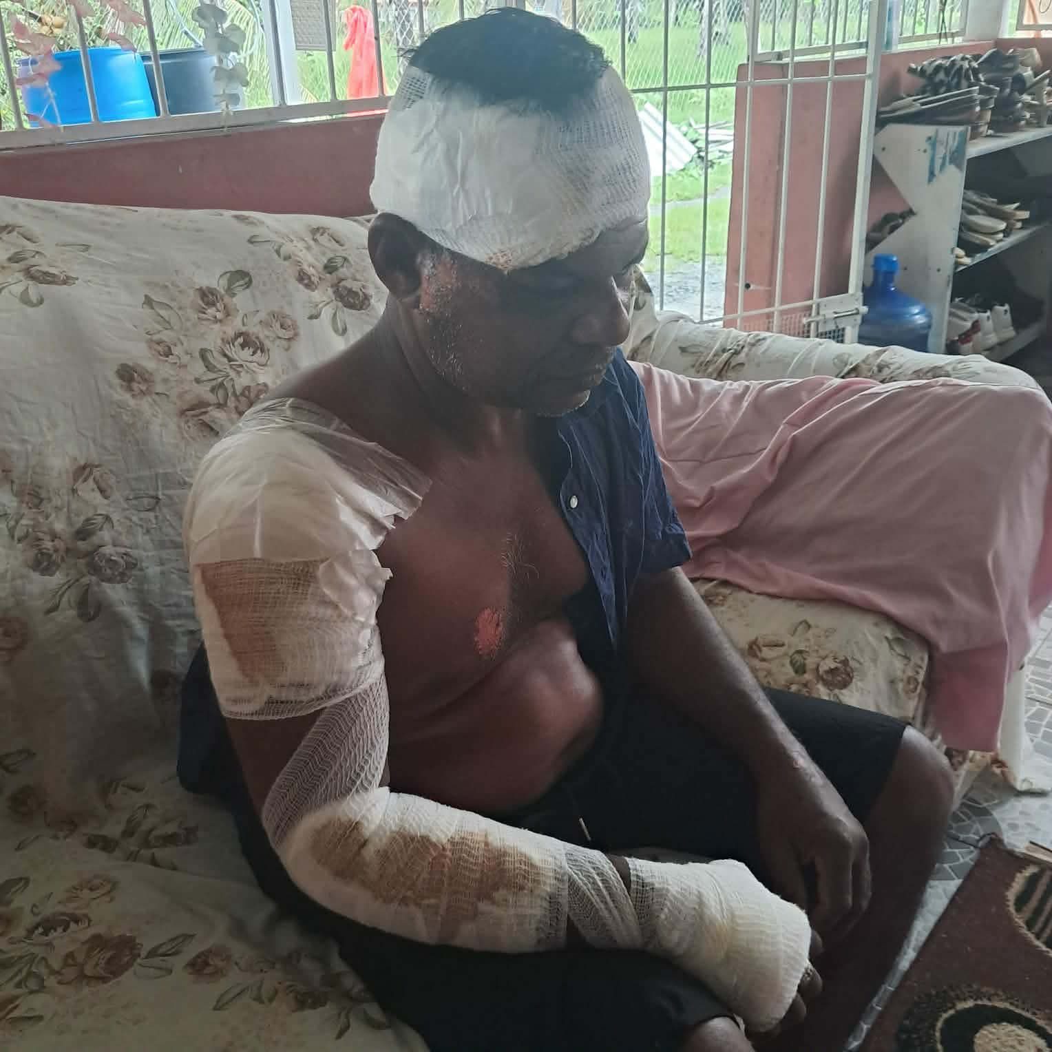 Man critical after struck by drunk driver on Independence Day