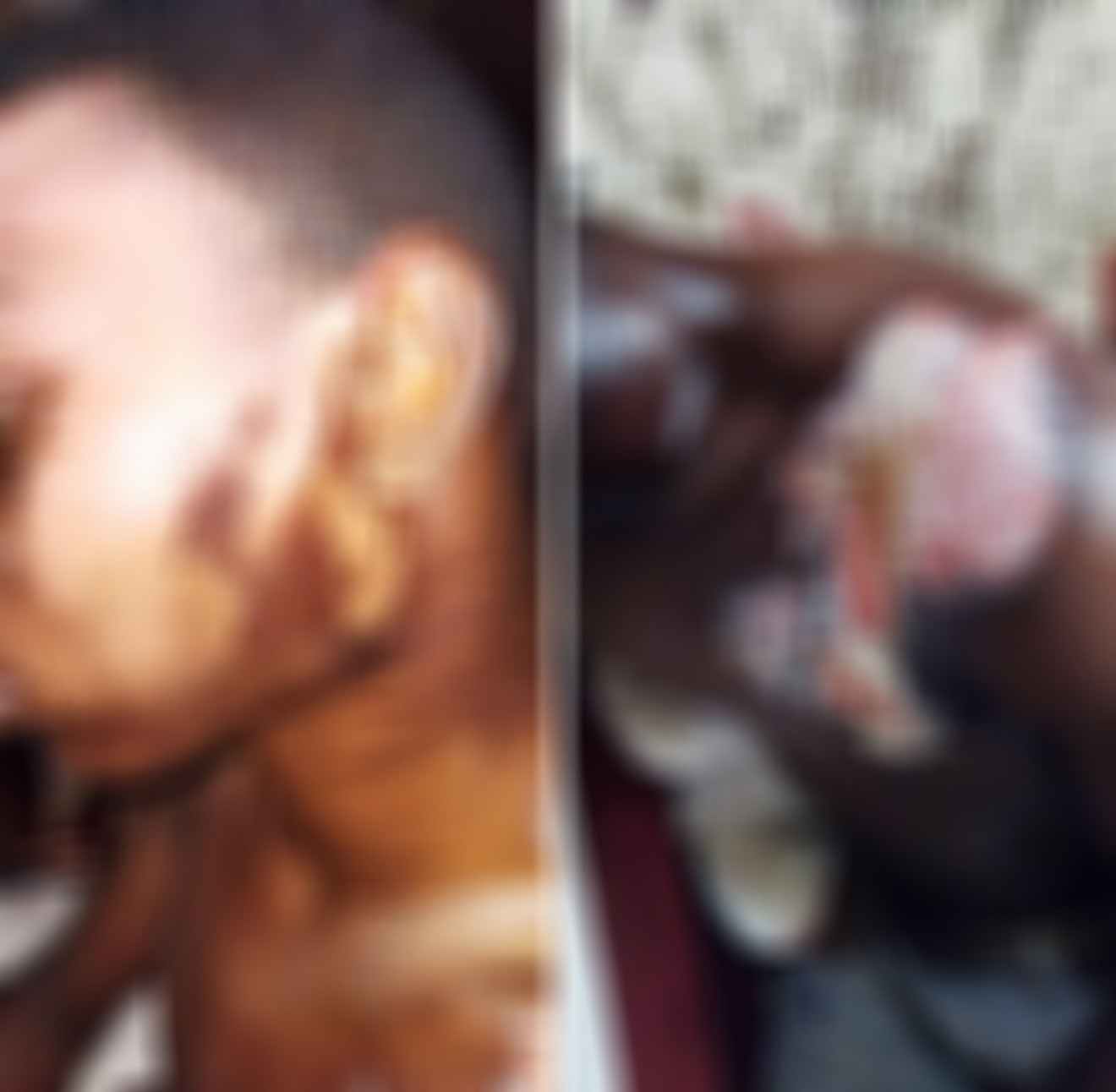 Training college student doused with corrosive substance while asleep in dorm