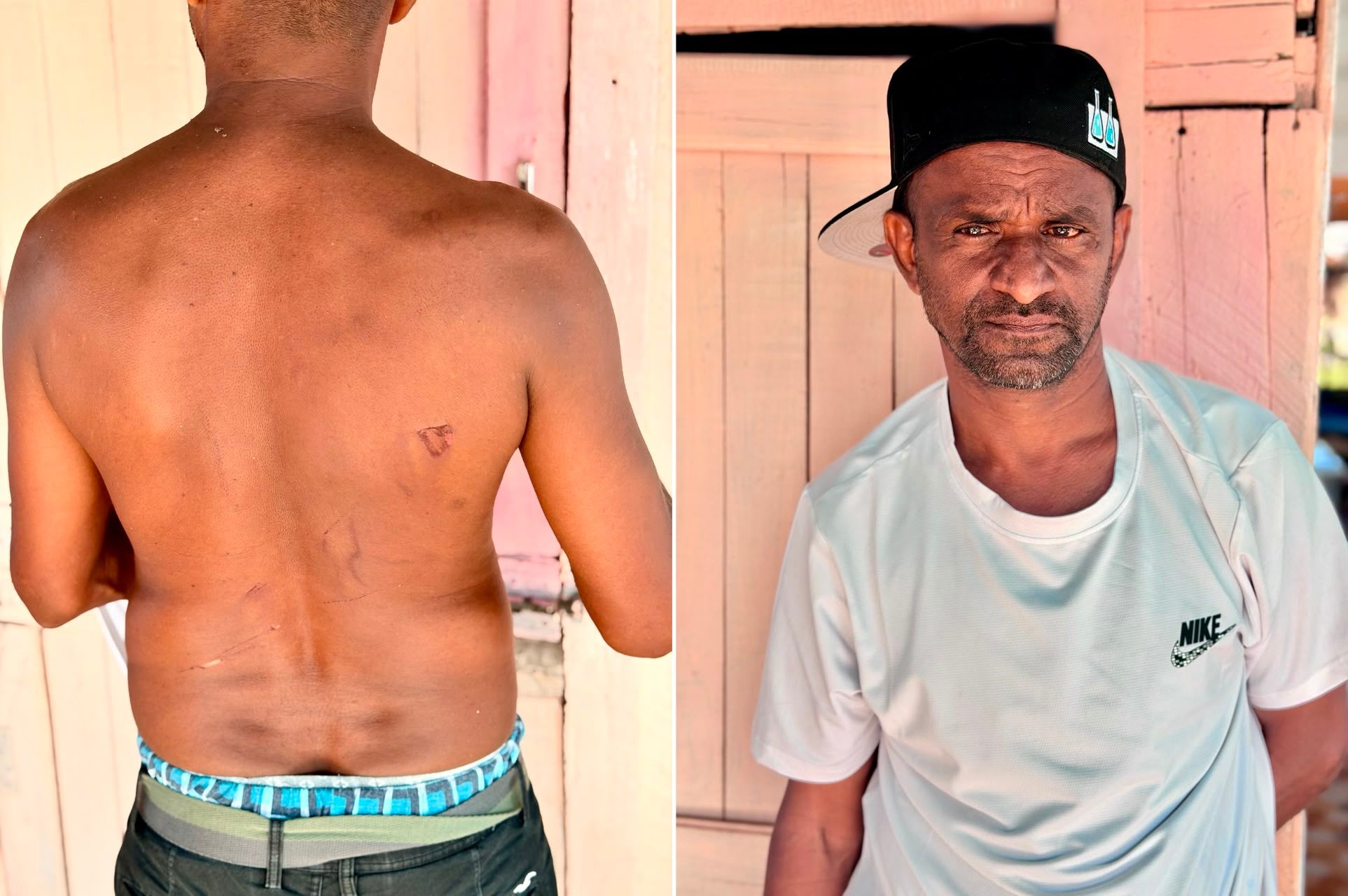 Corentyne family beaten and robbed of millions