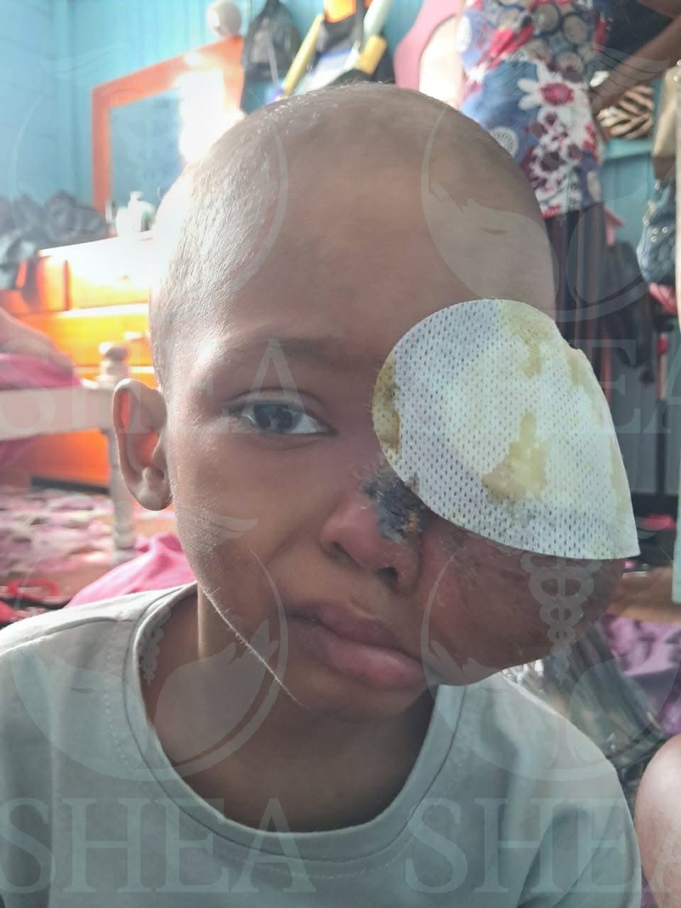 5-year-old needs US$25,000 for cancer treatment
